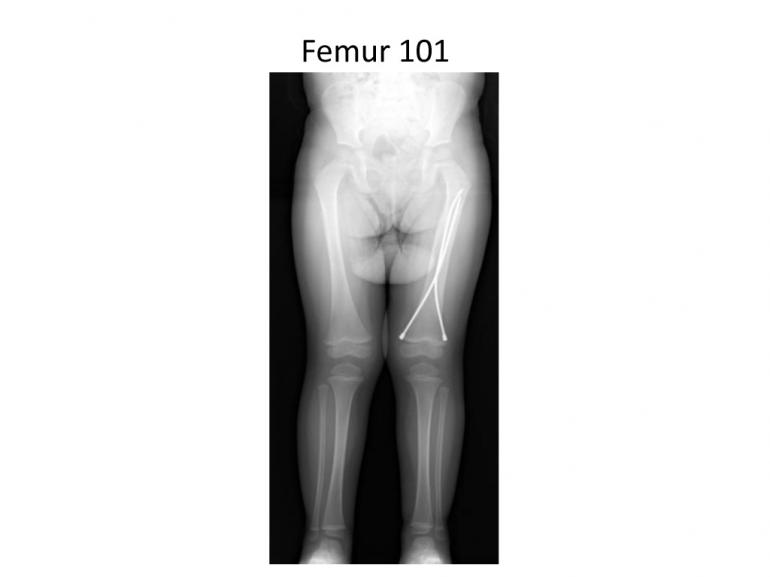 x-rays-7-5-11-70