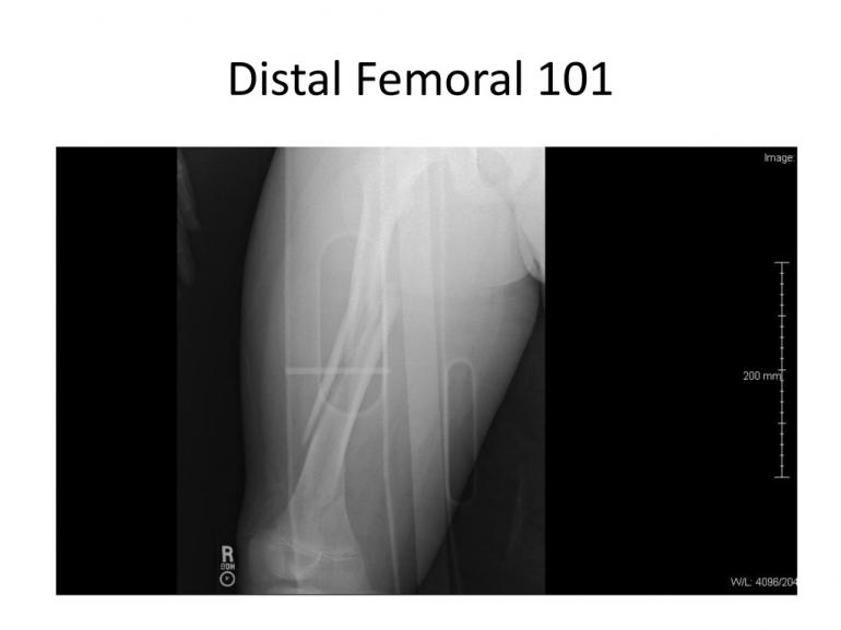 x-rays-7-5-11-10