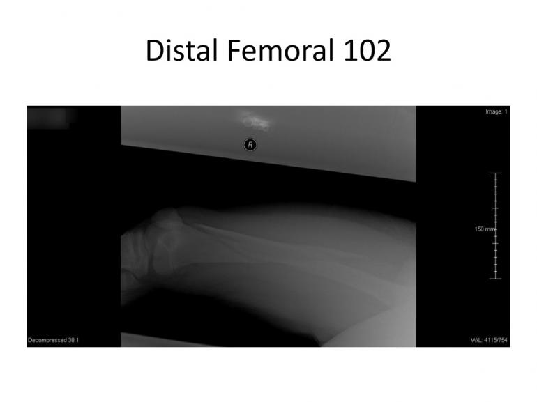 x-rays-7-5-11-11