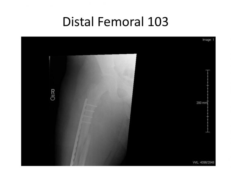 x-rays-7-5-11-12