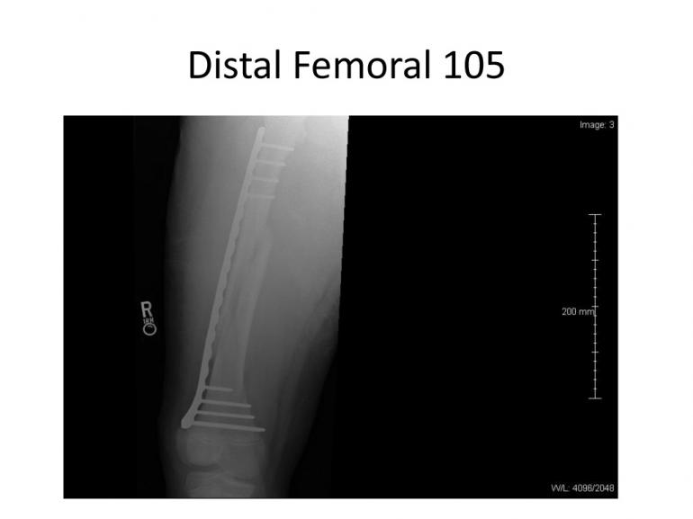 x-rays-7-5-11-14