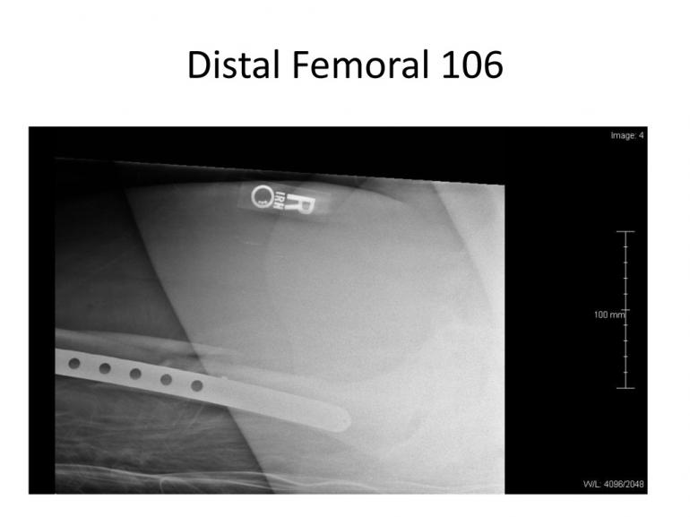 x-rays-7-5-11-15