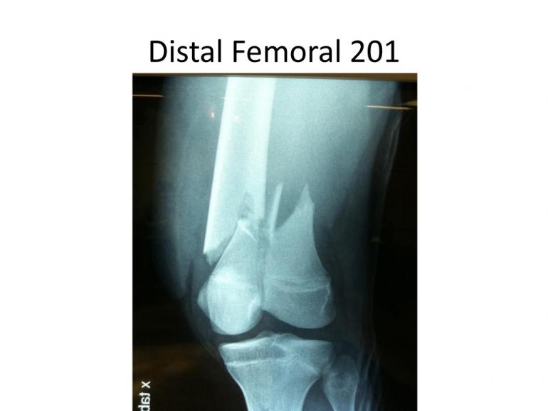 x-rays-7-5-11-16