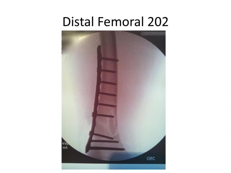 x-rays-7-5-11-17