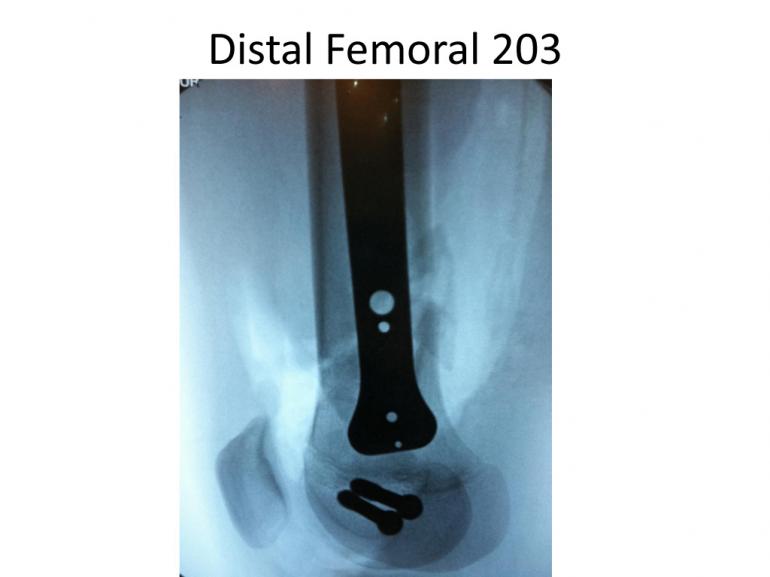 x-rays-7-5-11-18