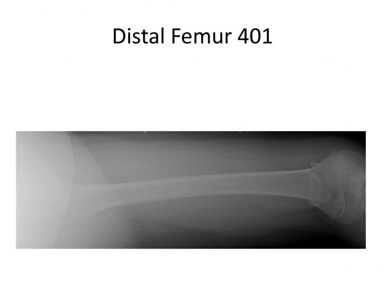 x-rays-7-5-11-21