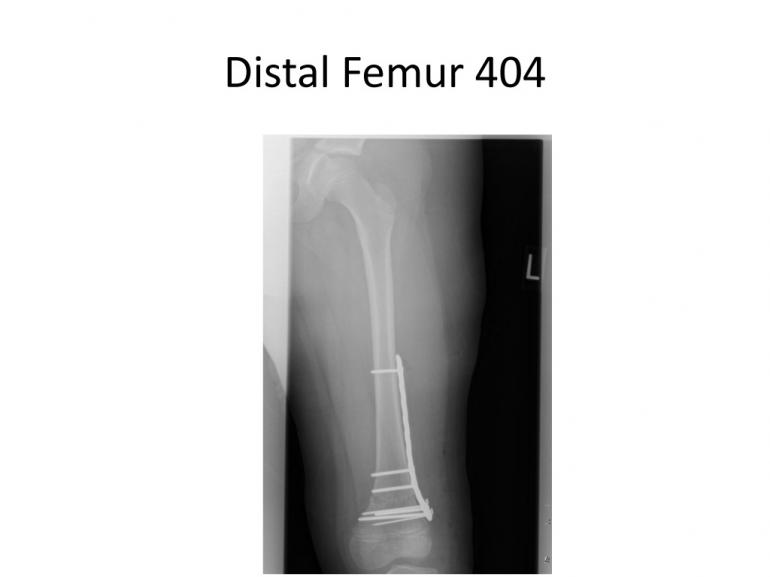 x-rays-7-5-11-24