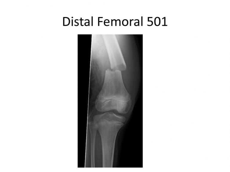 x-rays-7-5-11-25