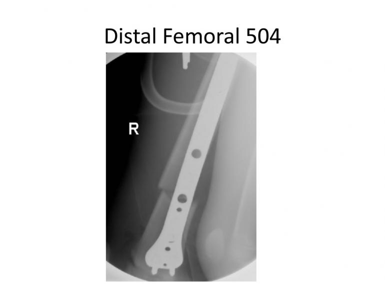 x-rays-7-5-11-28