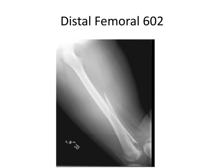 x-rays-7-5-11-30