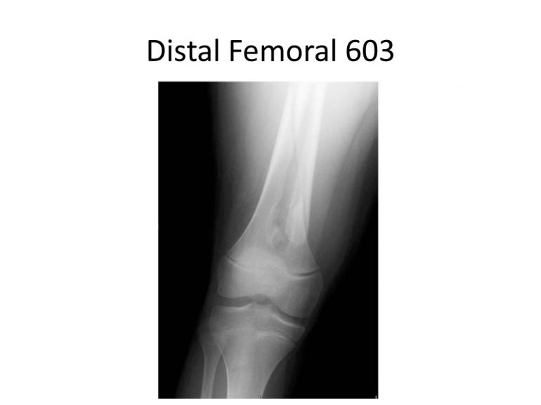 x-rays-7-5-11-31