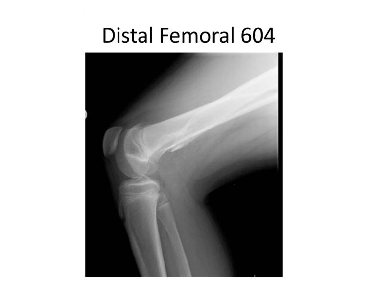 x-rays-7-5-11-32