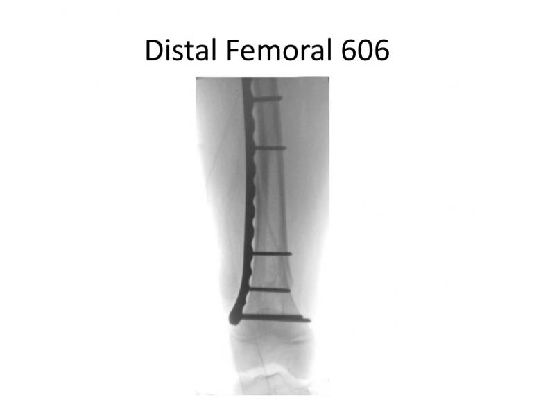 x-rays-7-5-11-34