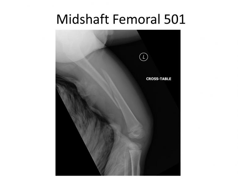 x-rays-7-5-11-35