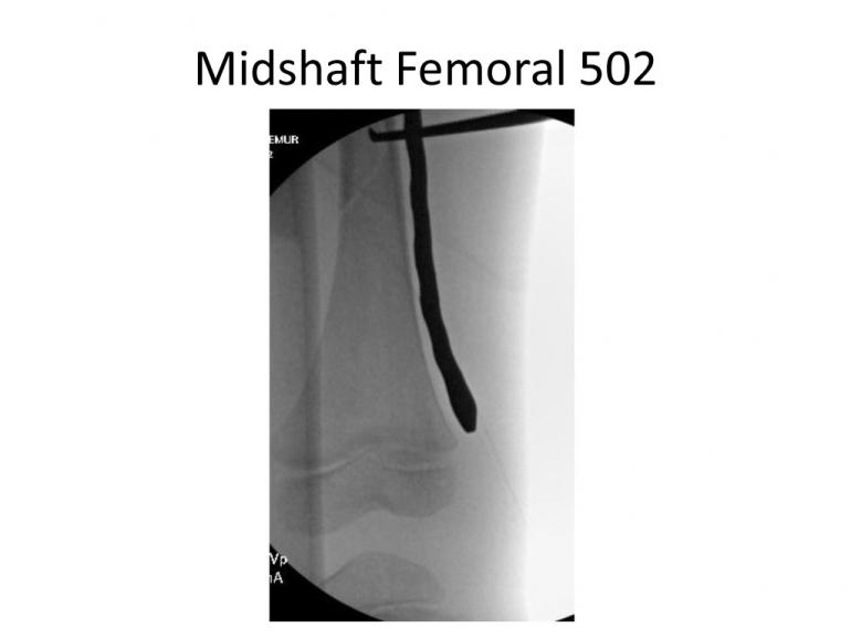 x-rays-7-5-11-36
