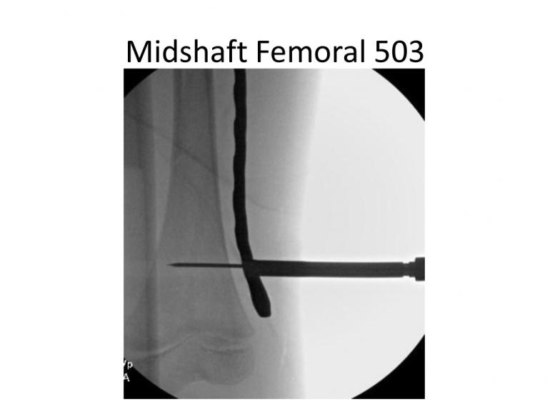 x-rays-7-5-11-37