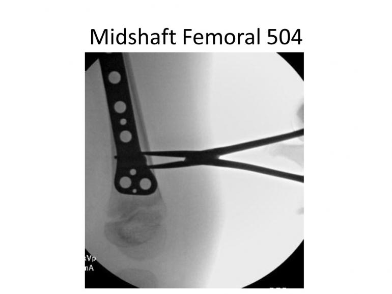 x-rays-7-5-11-38