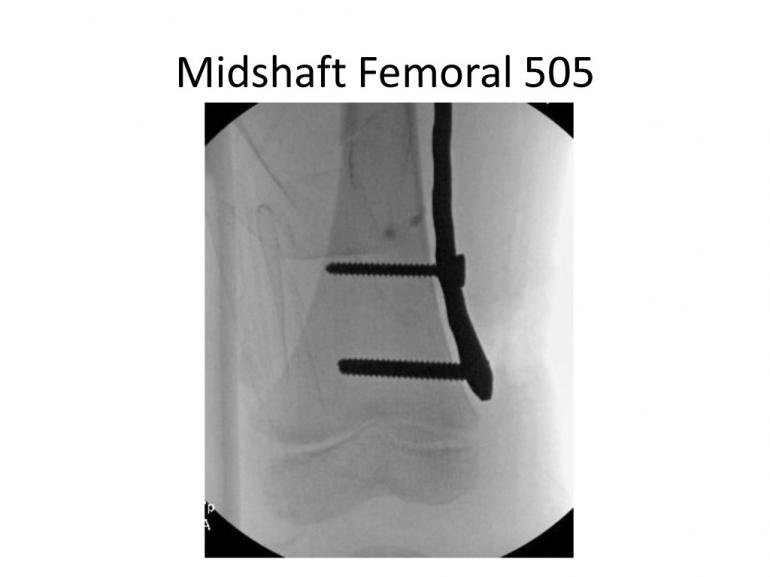 x-rays-7-5-11-39