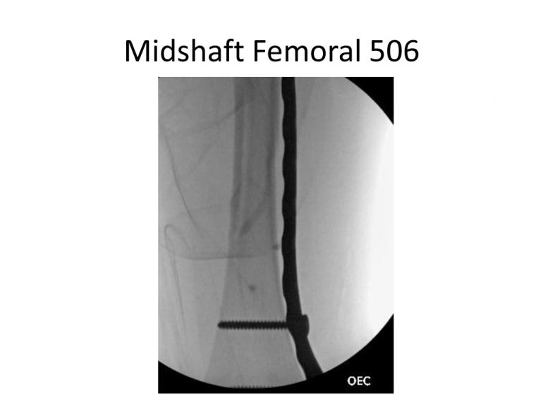 x-rays-7-5-11-40