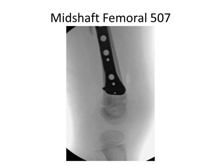 x-rays-7-5-11-41