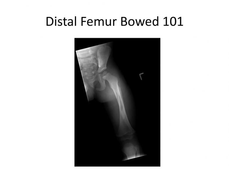 x-rays-7-5-11-44