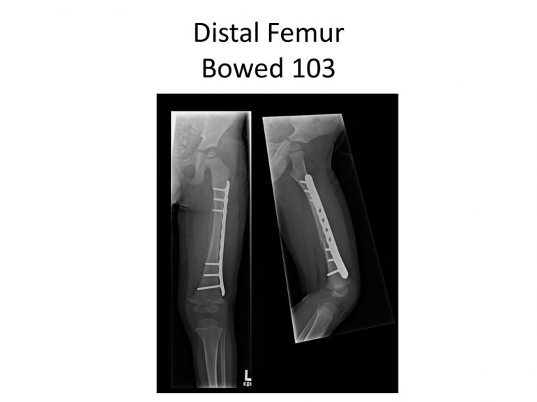 x-rays-7-5-11-46