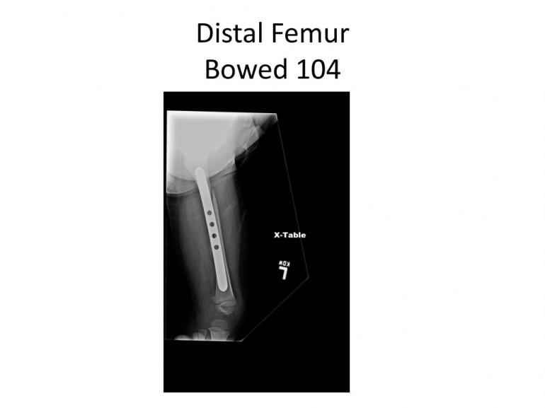x-rays-7-5-11-47