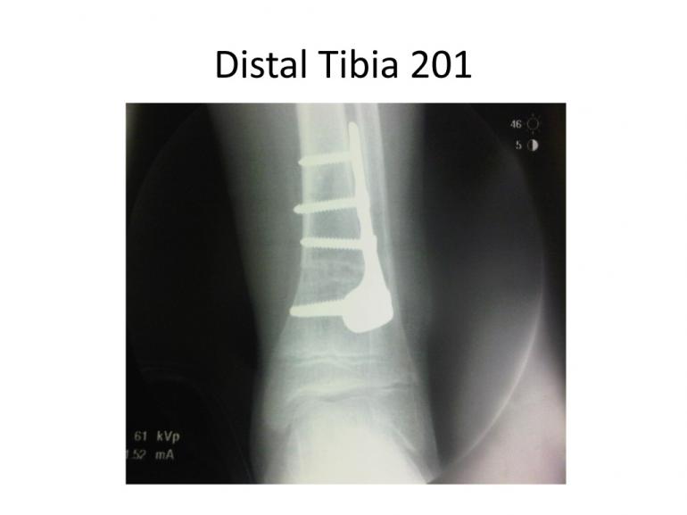 x-rays-7-5-11-5