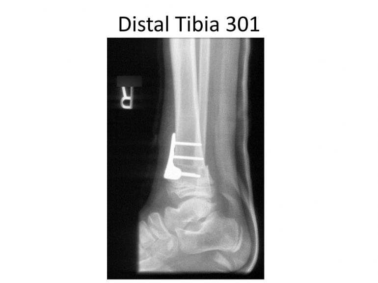 x-rays-7-5-11-6