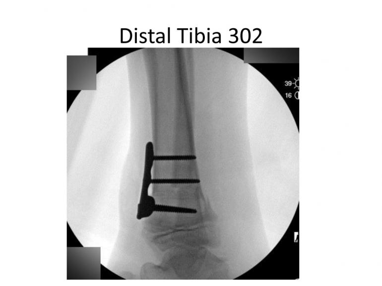 x-rays-7-5-11-7
