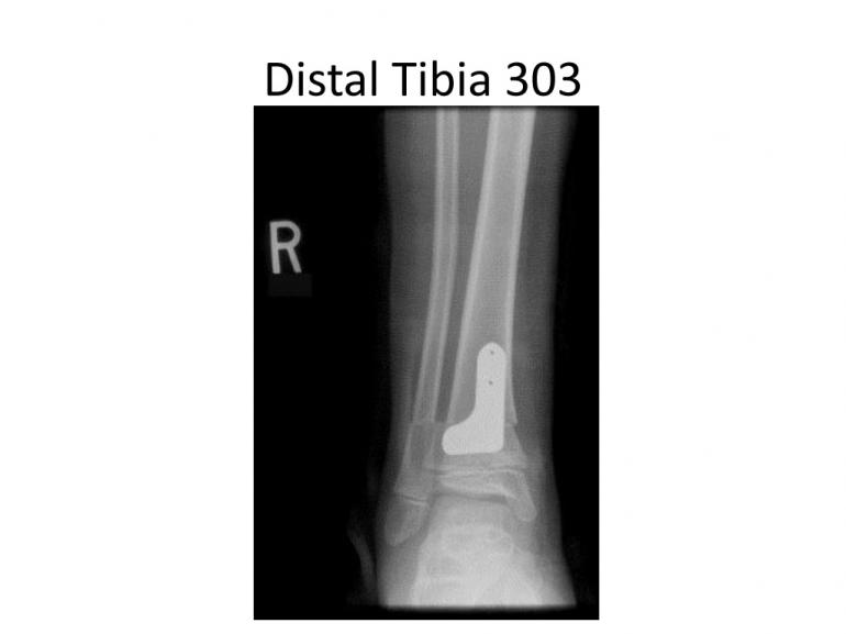 x-rays-7-5-11-8