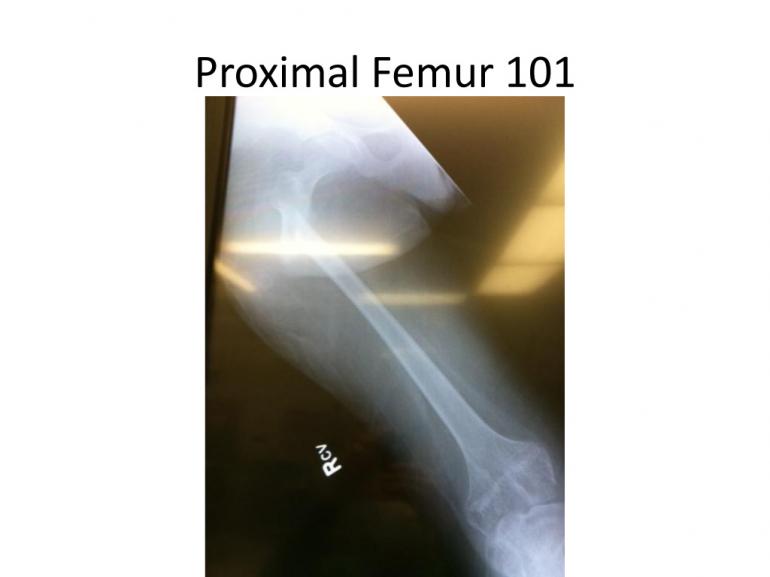 x-rays-7-5-11-60