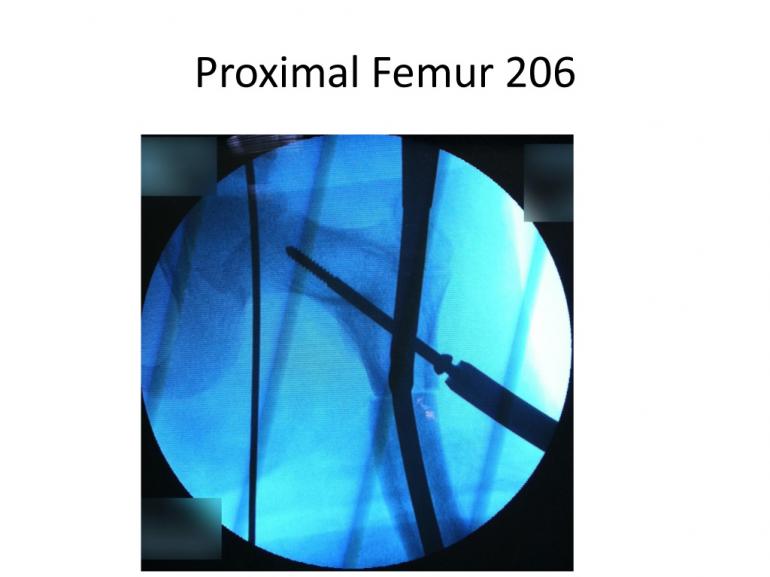 x-rays-7-5-11-67