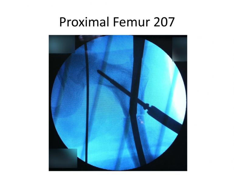 x-rays-7-5-11-68