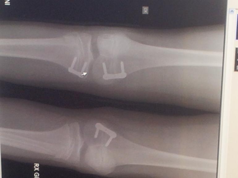2012-09-13 11.42.06
