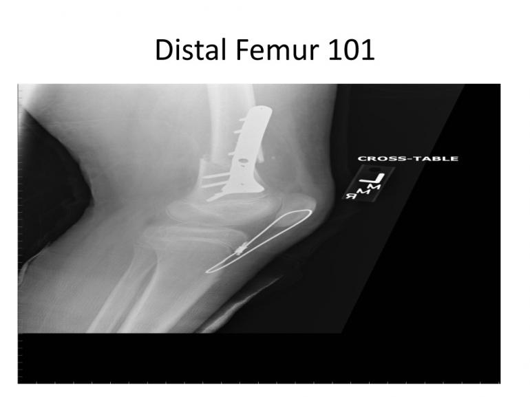 x-rays-7-5-11-49