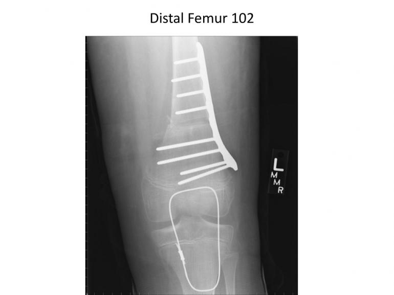 x-rays-7-5-11-50