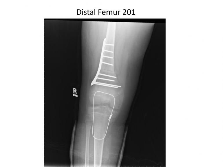 x-rays-7-5-11-51