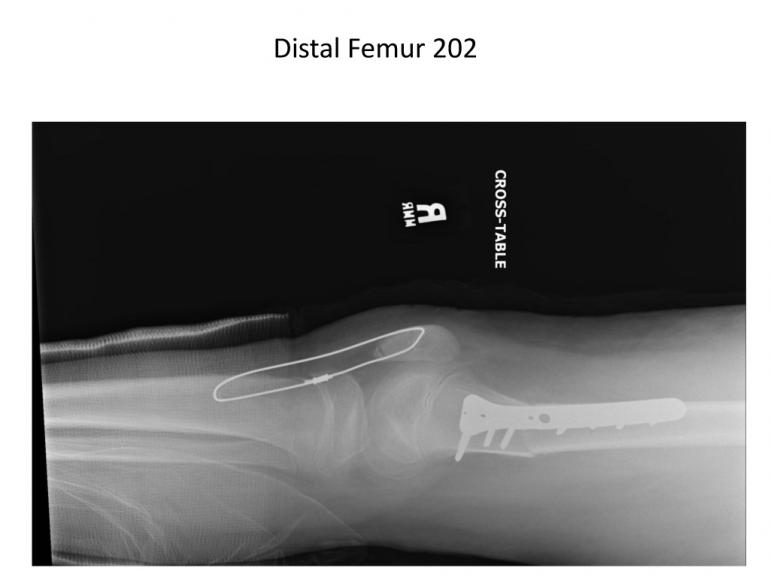 x-rays-7-5-11-52