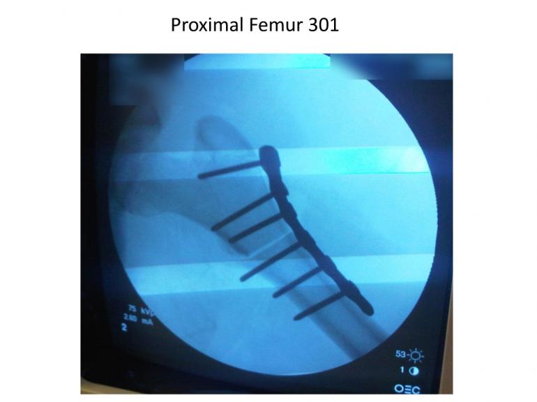 x-rays-7-5-11-53