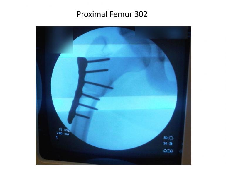 x-rays-7-5-11-54