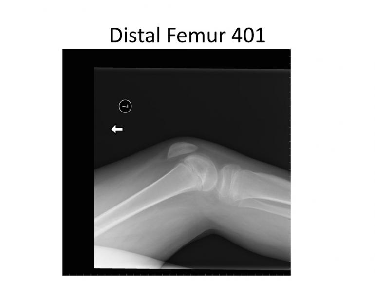 x-rays-7-5-11-55